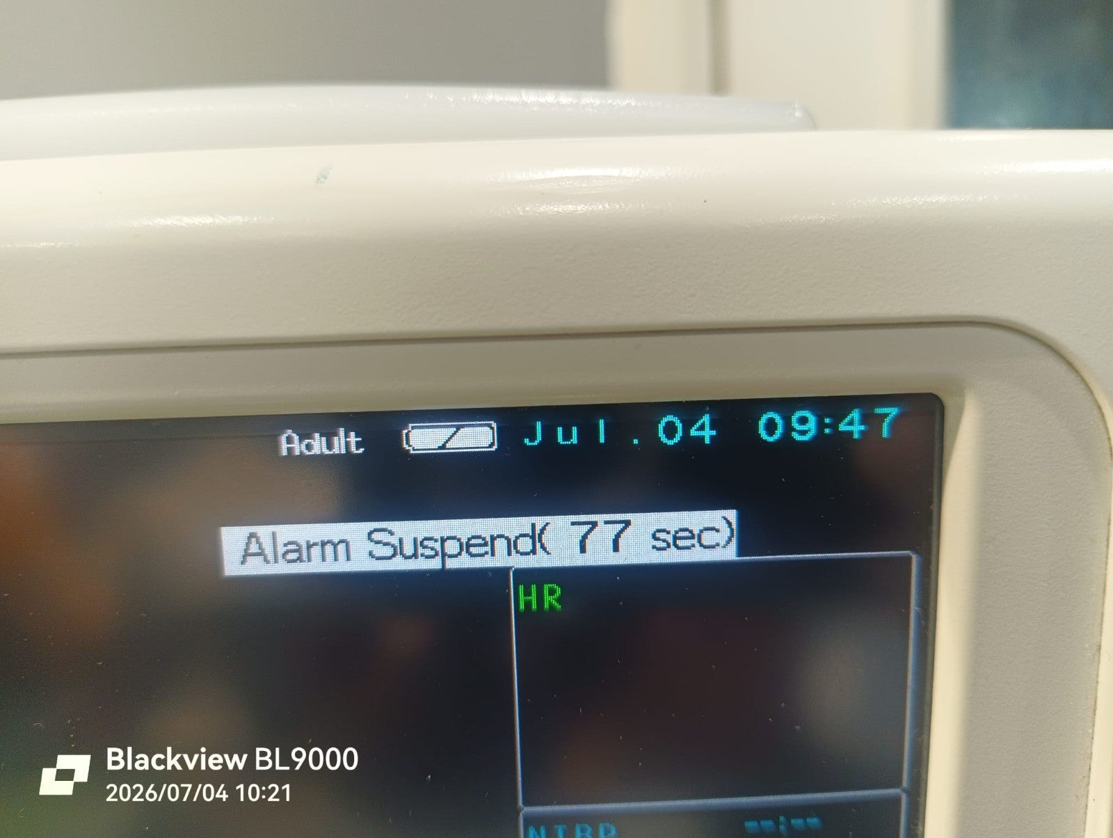 v1|168510969118|0